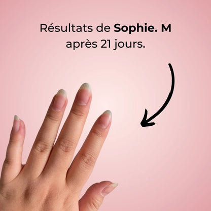 SÉRUM DE CROISSANCE DES ONGLES (1 ACHETÉ = 1 OFFERT)