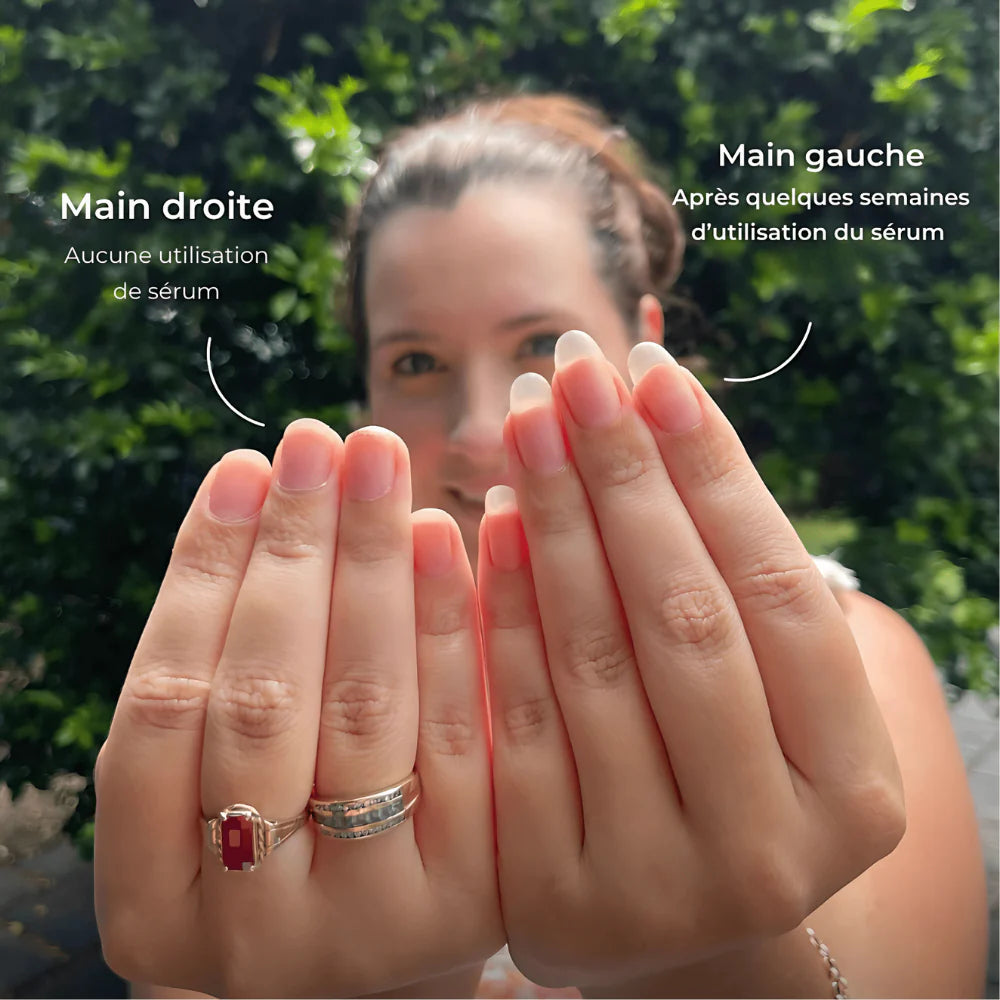 SÉRUM DE CROISSANCE DES ONGLES (1 ACHETÉ = 1 OFFERT)
